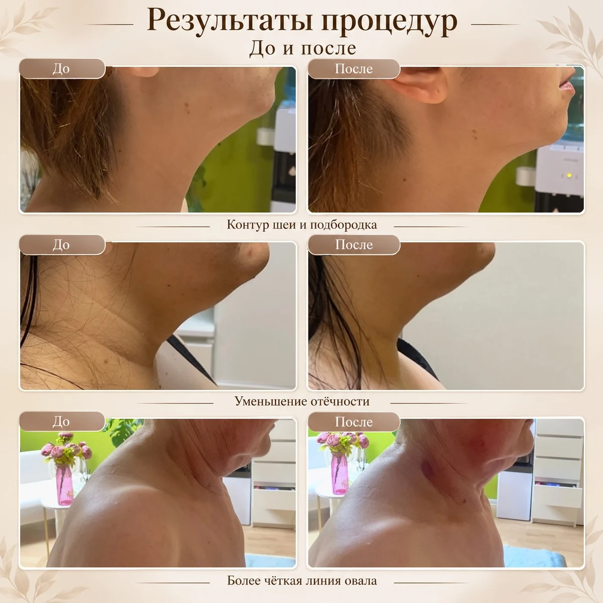 Коллаж сравнений до и после: область нижней части лица и шеи